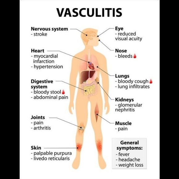 Meet your Posher, Angela - Picture 7 of 7